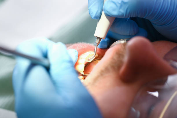 Best Emergency Treatment for Toothache in Elwood, UT