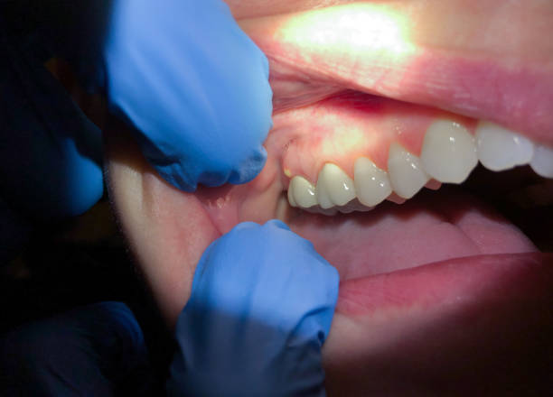 Best Walk-In Emergency Dentist in Elwood, UT